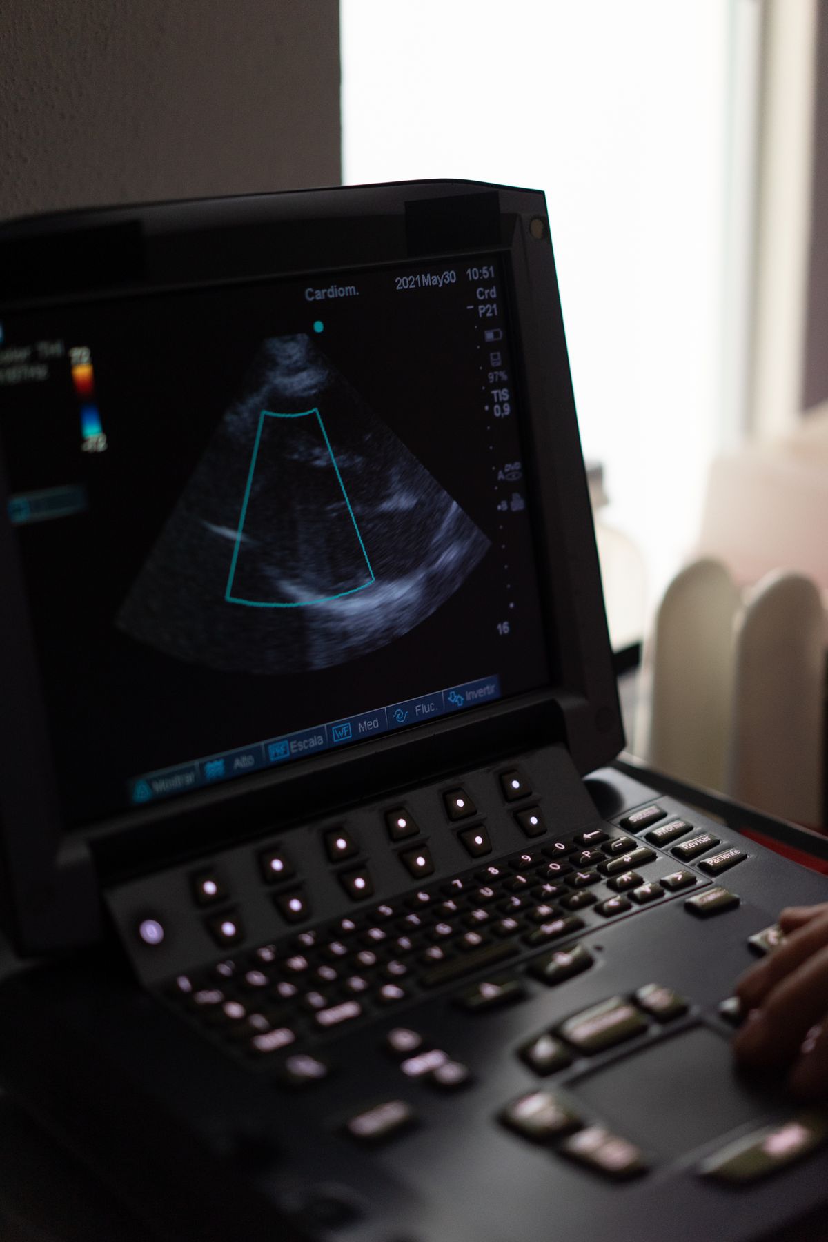 Ultrasonography (USG)